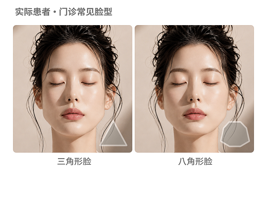 门诊常见脸型