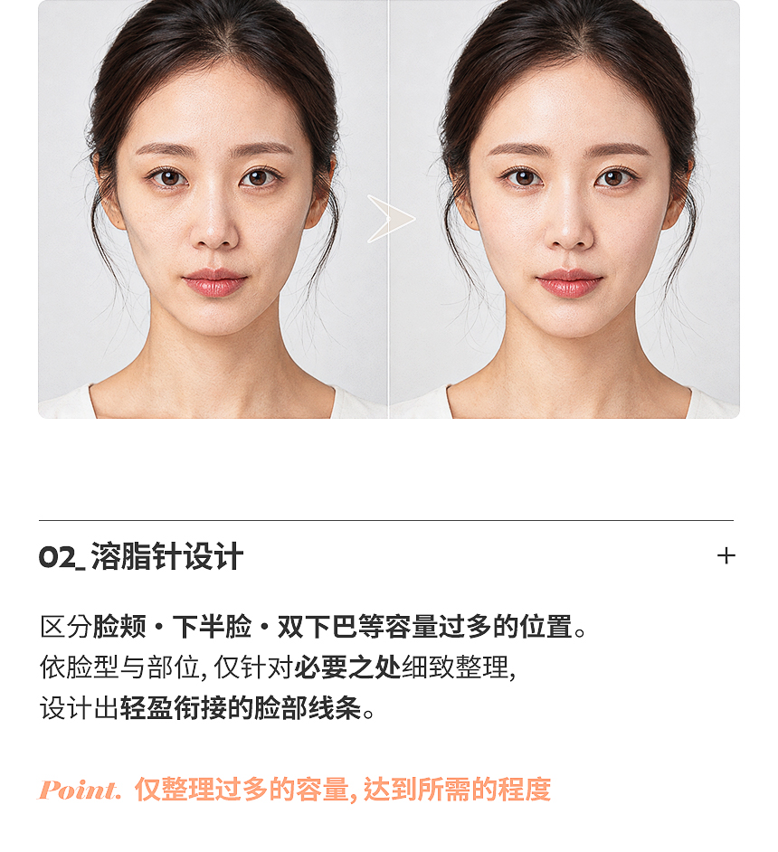 自然衔接凹陷部位的填充剂设计