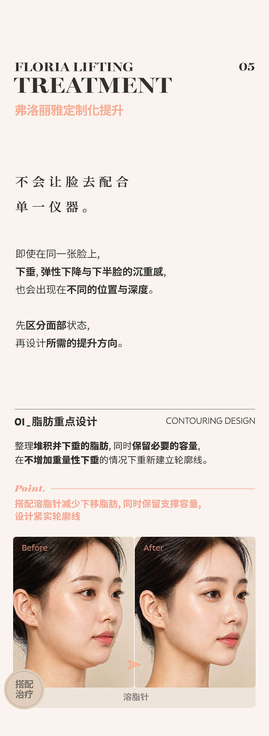不会让脸去配合单一仪器。