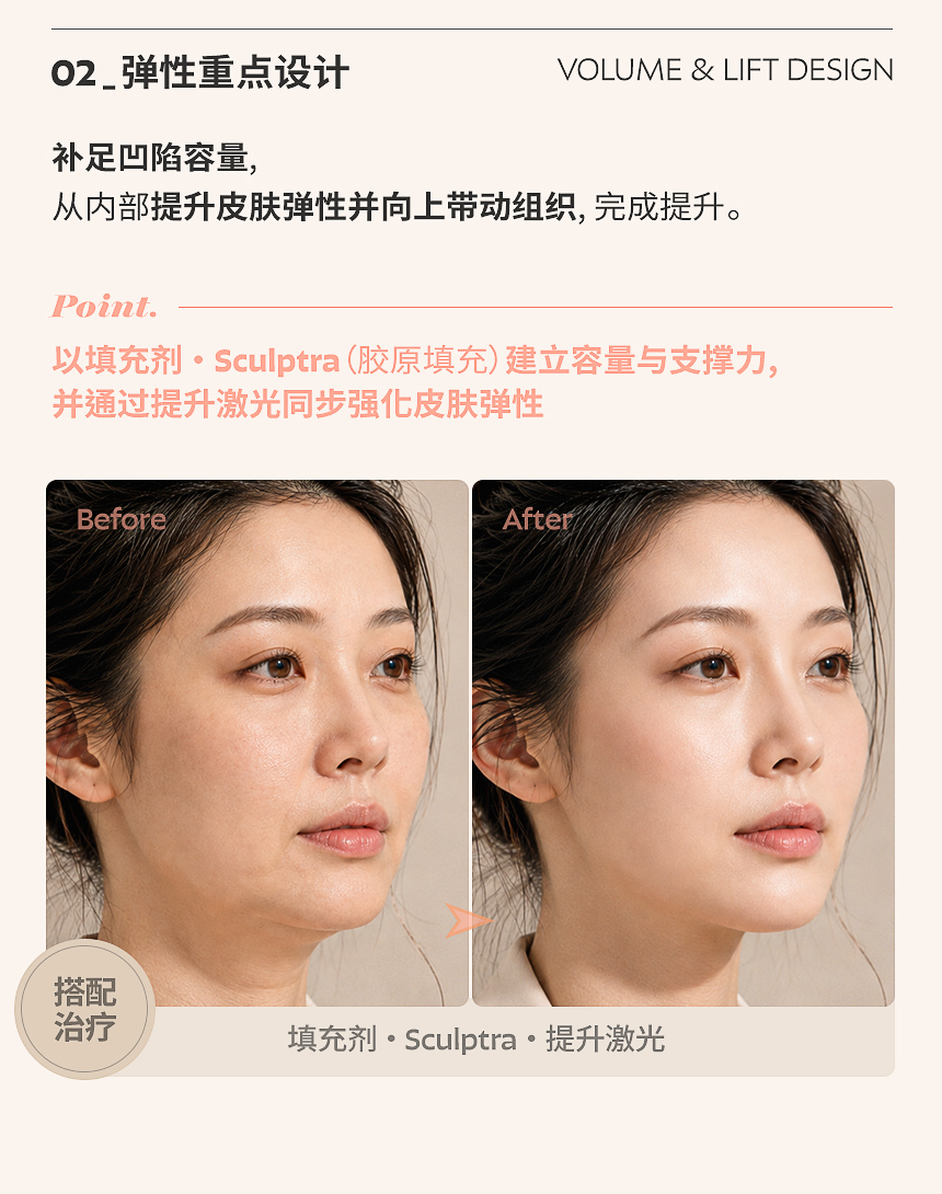 整理堆积并下垂的脂肪，同时保留必要的容量，在不增加重量性下垂的情况下重新建立轮廓线。