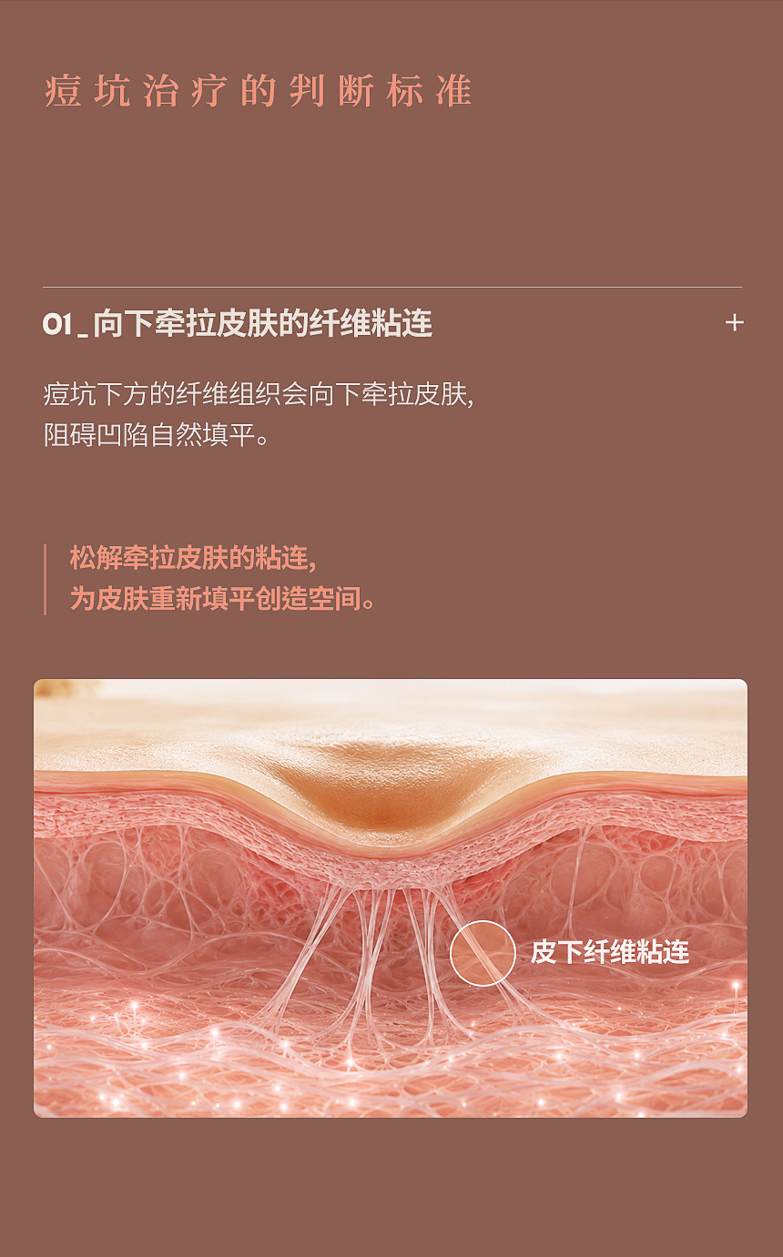痘坑纤维粘连松解治疗