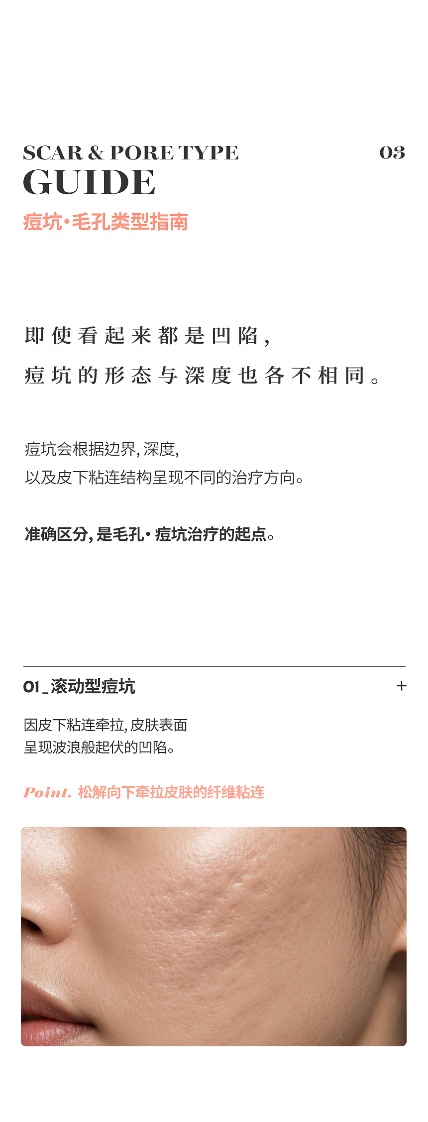 痘坑·毛孔类型与治疗指南