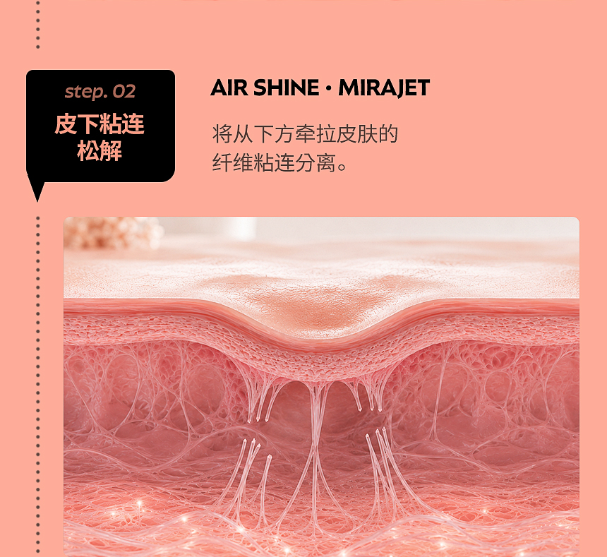 AIR SHINE·MIRAJET 皮下粘连松解治疗