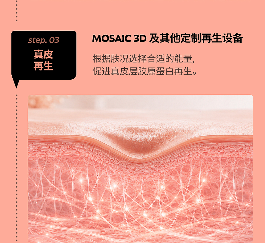 MOSAIC 3D 痘坑·毛孔真皮再生治疗