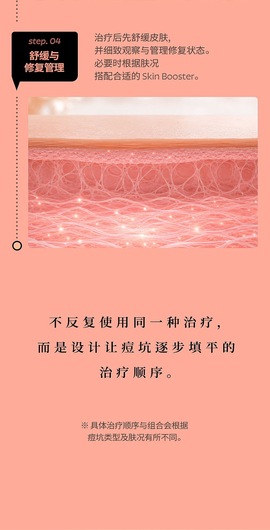 痘坑治疗后的真皮再生与恢复护理