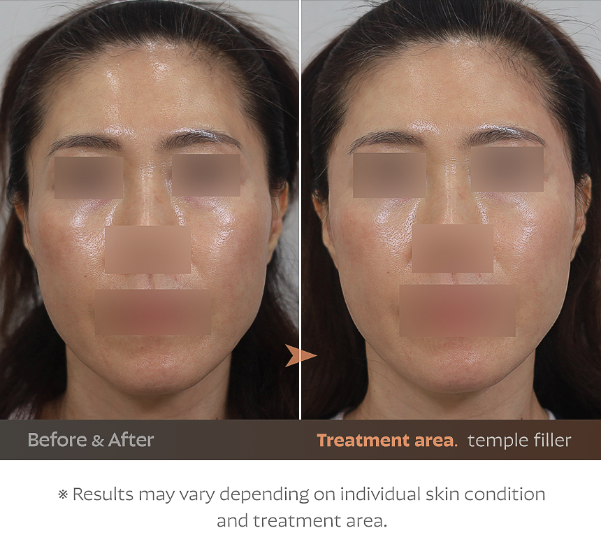 Face shape width and ratio guide