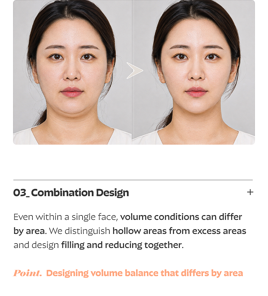 Fat-dissolving injection design for excess volume