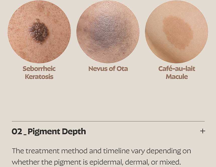 Busan FLORIA Clinic pigmentation treatment