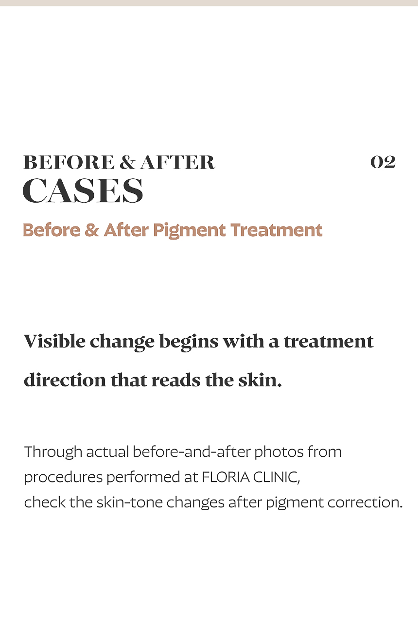 Busan FLORIA Clinic pigmentation treatment