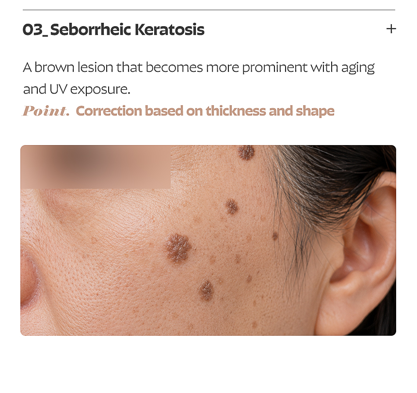 Busan FLORIA Clinic pigmentation treatment