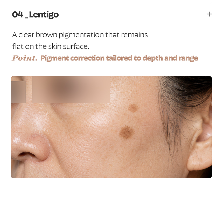 Busan FLORIA Clinic pigmentation treatment