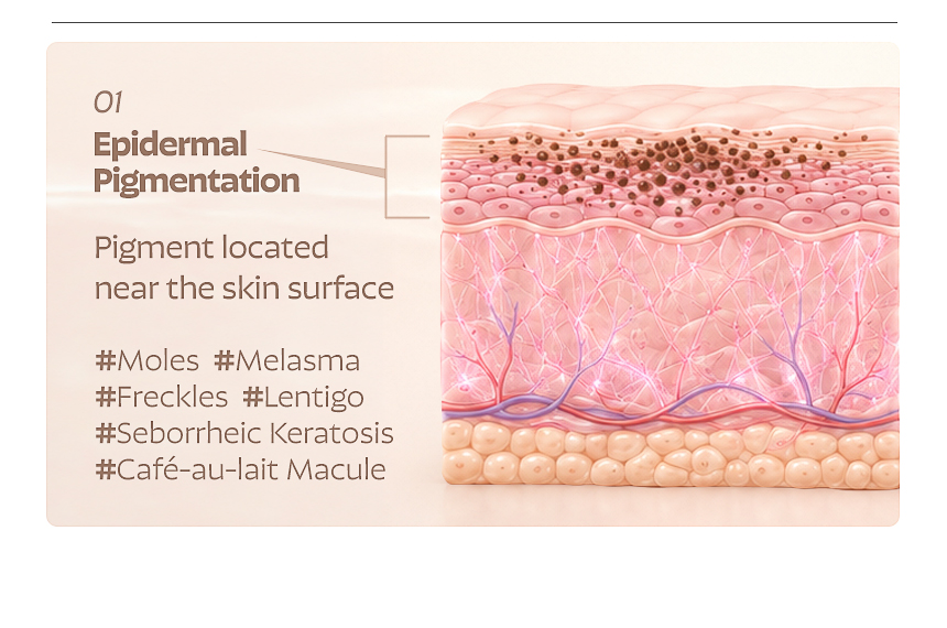 Busan FLORIA Clinic pigmentation treatment