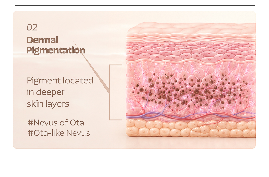 Busan FLORIA Clinic pigmentation treatment