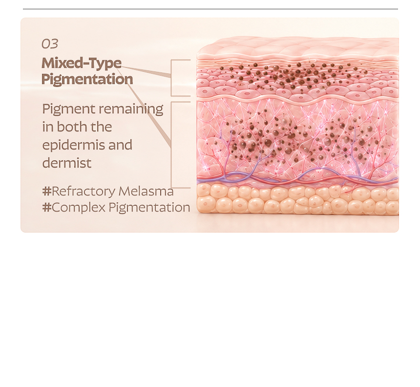 Busan FLORIA Clinic pigmentation treatment