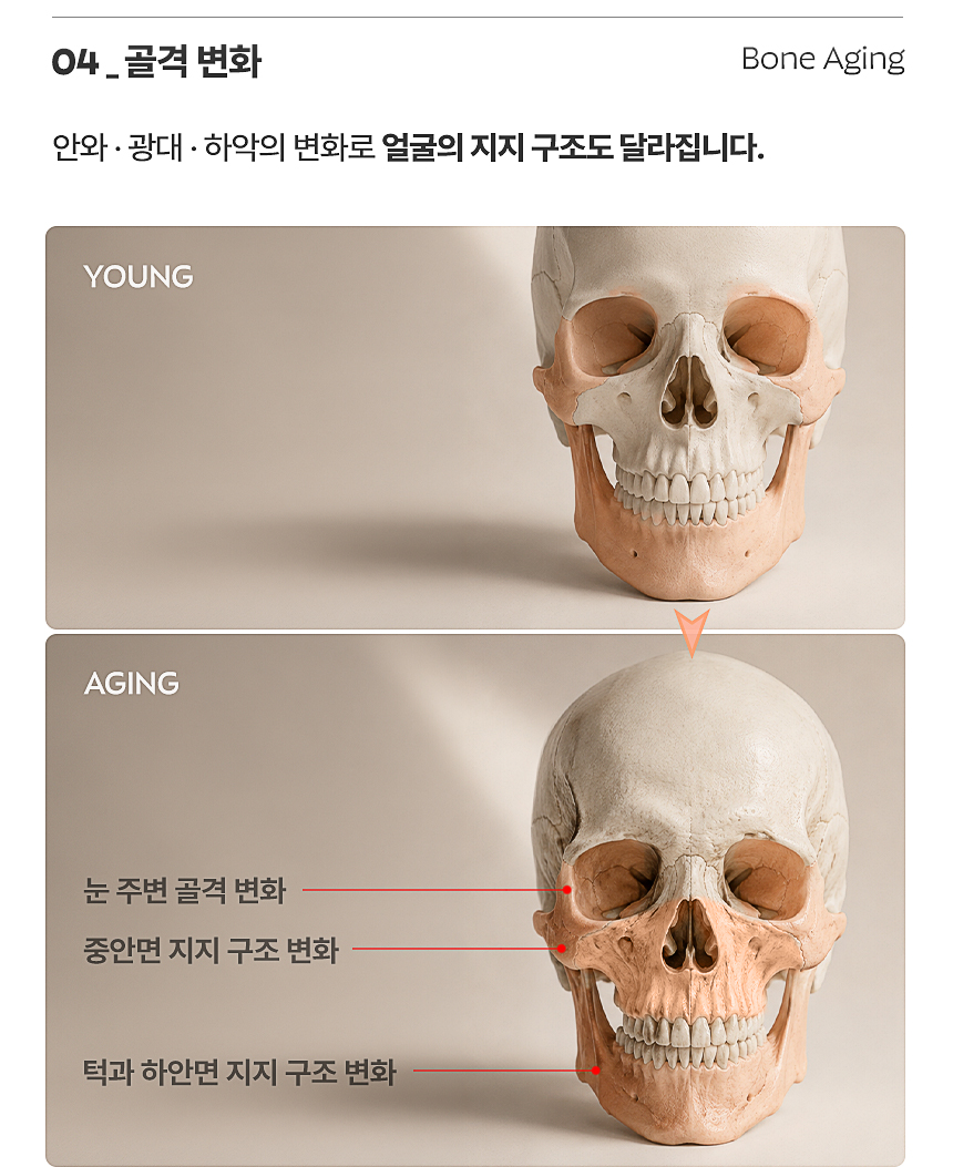 소프웨이브 피부 탄력 리프팅