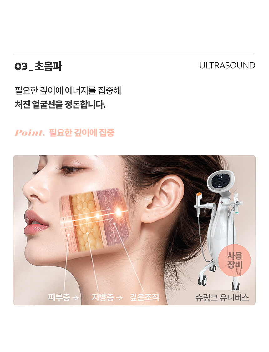 흡수성 실을 이용한 얼굴 리프팅