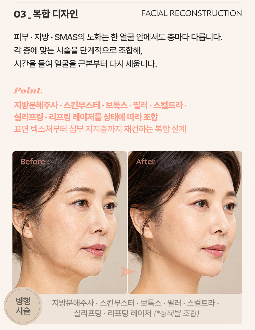 초음파 고주파 실리프팅 비교