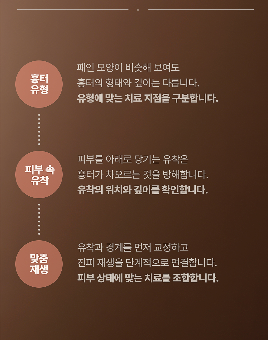패인 여드름 흉터 유형과 피부 속 유착 분석