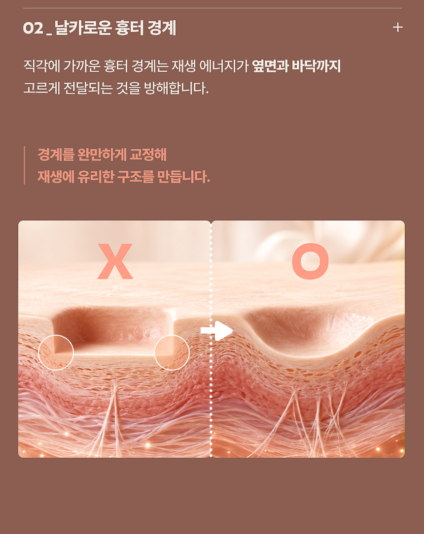 여드름 흉터 날카로운 경계 교정과 진피 재생