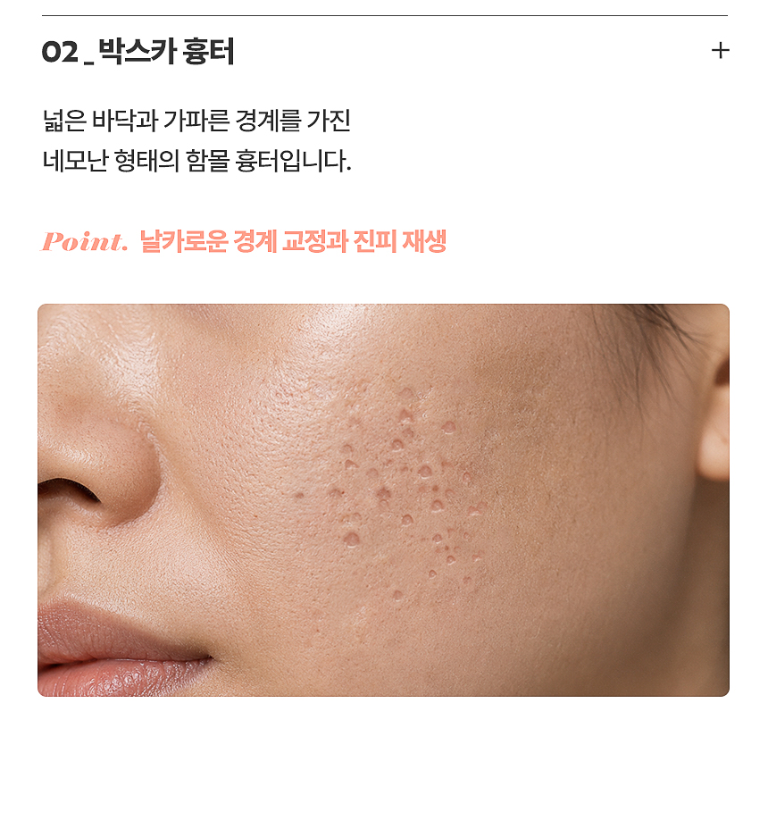 박스카 여드름 흉터 함몰 흉터 치료