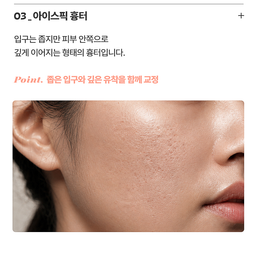 아이스픽 여드름 흉터 깊은 패인 흉터 치료