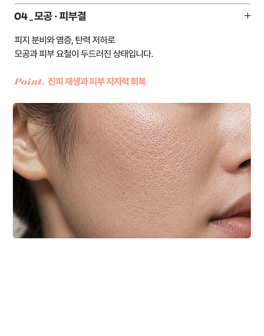 넓어진 모공·피부결 개선과 진피 재생 치료