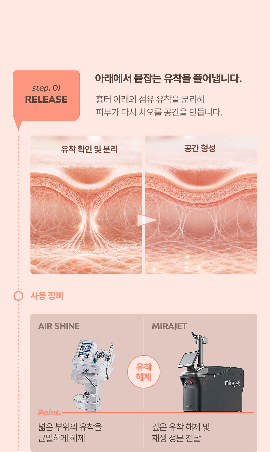 AIR SHINE·MIRAJET 여드름 흉터 유착 해제 치료