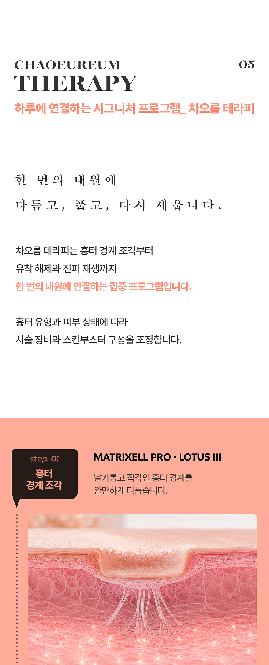 플로리아 차오름 테라피 여드름 흉터 집중 치료 프로그램