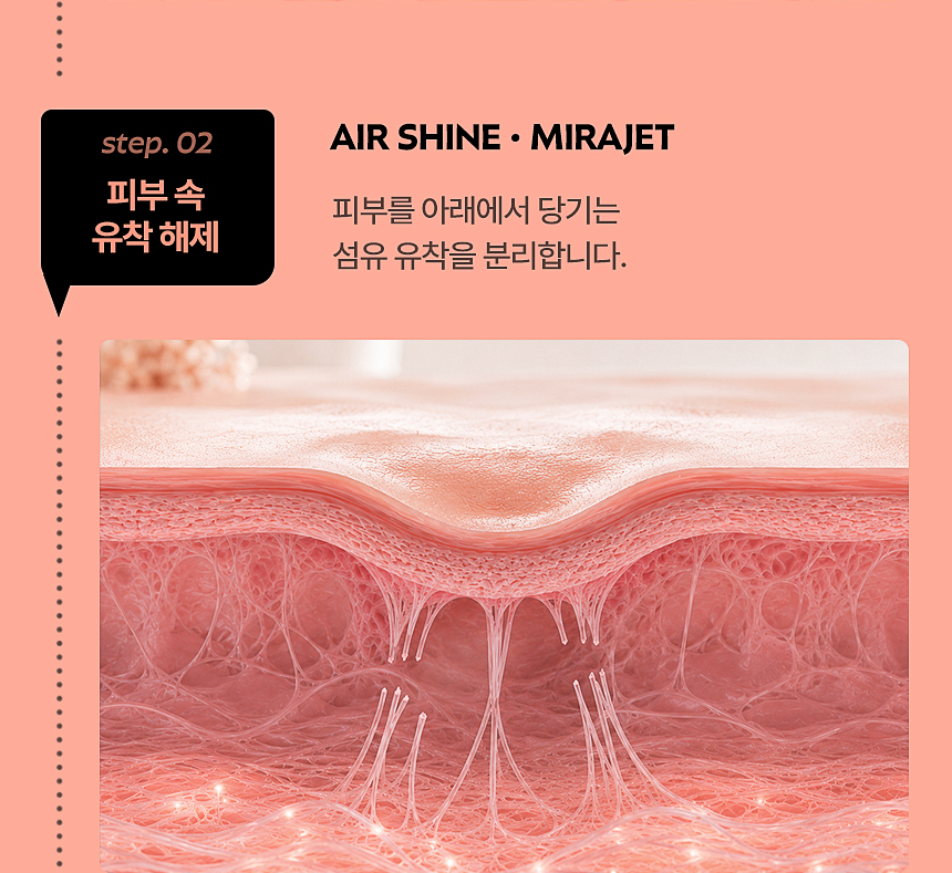 AIR SHINE·MIRAJET 피부 속 섬유 유착 해제