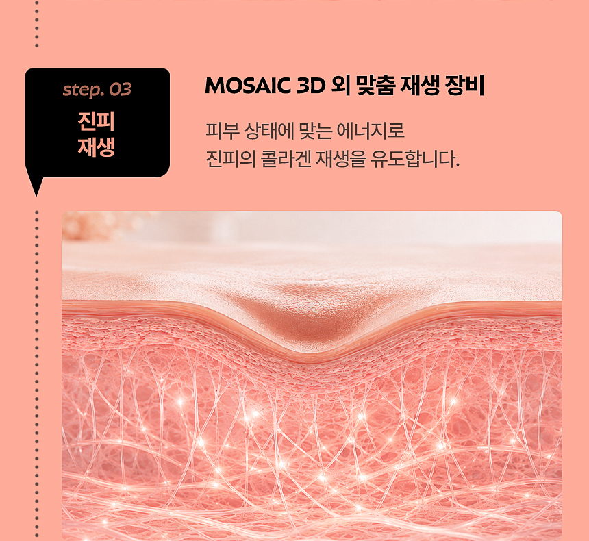 MOSAIC 3D 여드름 흉터·모공 진피 재생