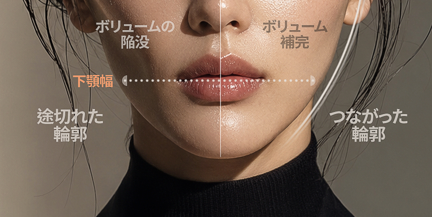 横頬とあごの顔型デザイン症例
