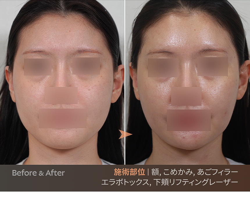 顔型デザインの結果に関する個人差の案内