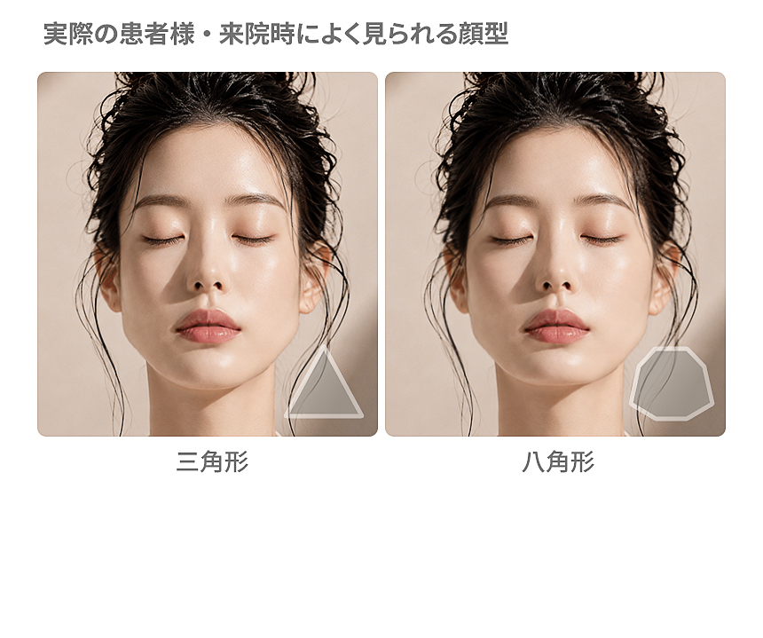 来院時によく見られる顔型