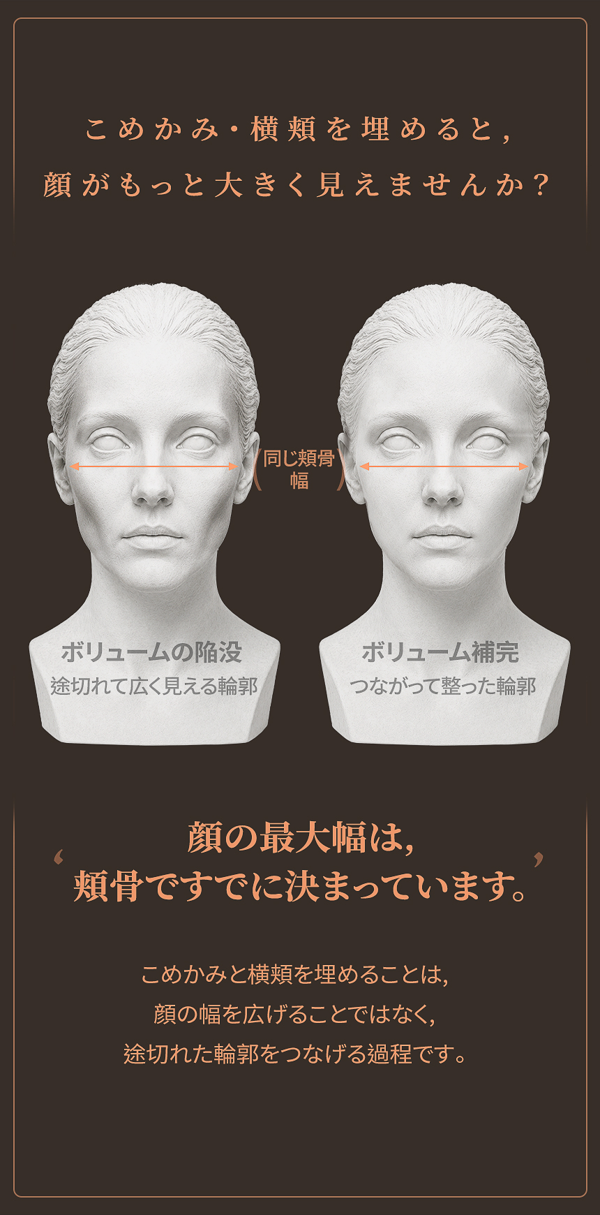 こめかみと横頬のくぼみによる輪郭の変化