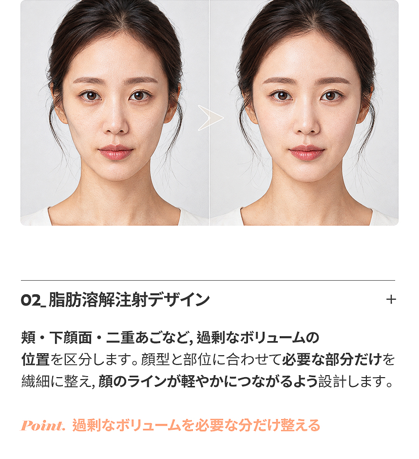 くぼんだ部位をつなぐフィラーデザイン