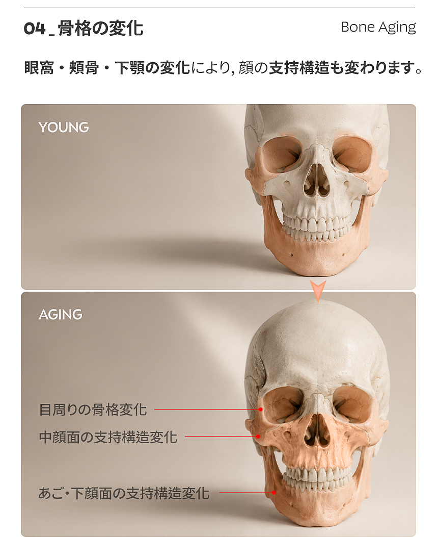 たるみ + 弾力の複合設計