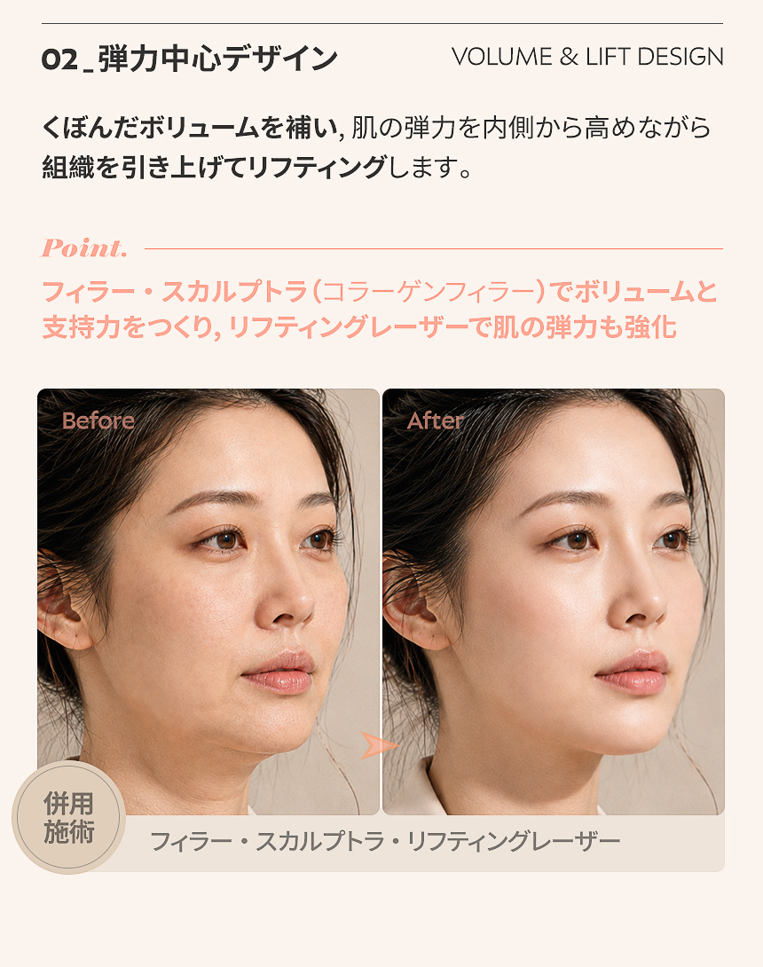 蓄積して下がった脂肪は整え、必要なボリュームは残し、重さによるたるみを増やさずに輪郭線を立て直します。