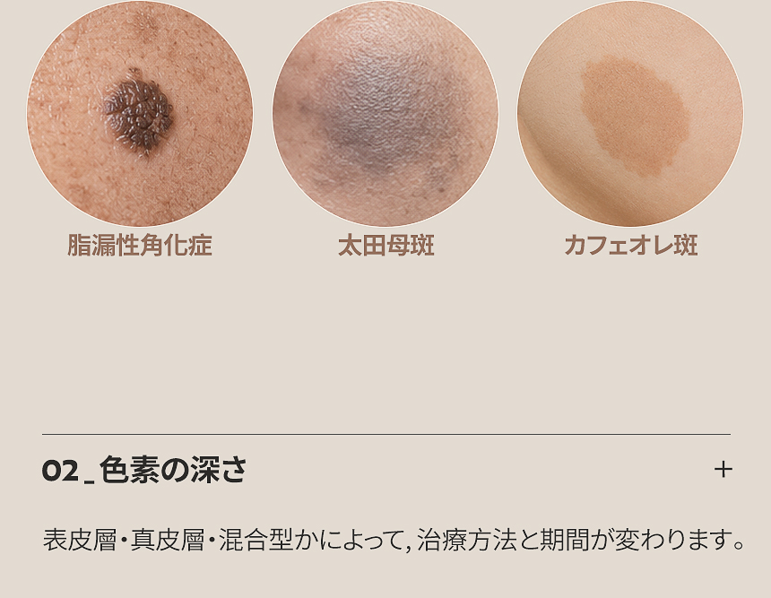 フロリア 色素補正治療の症例