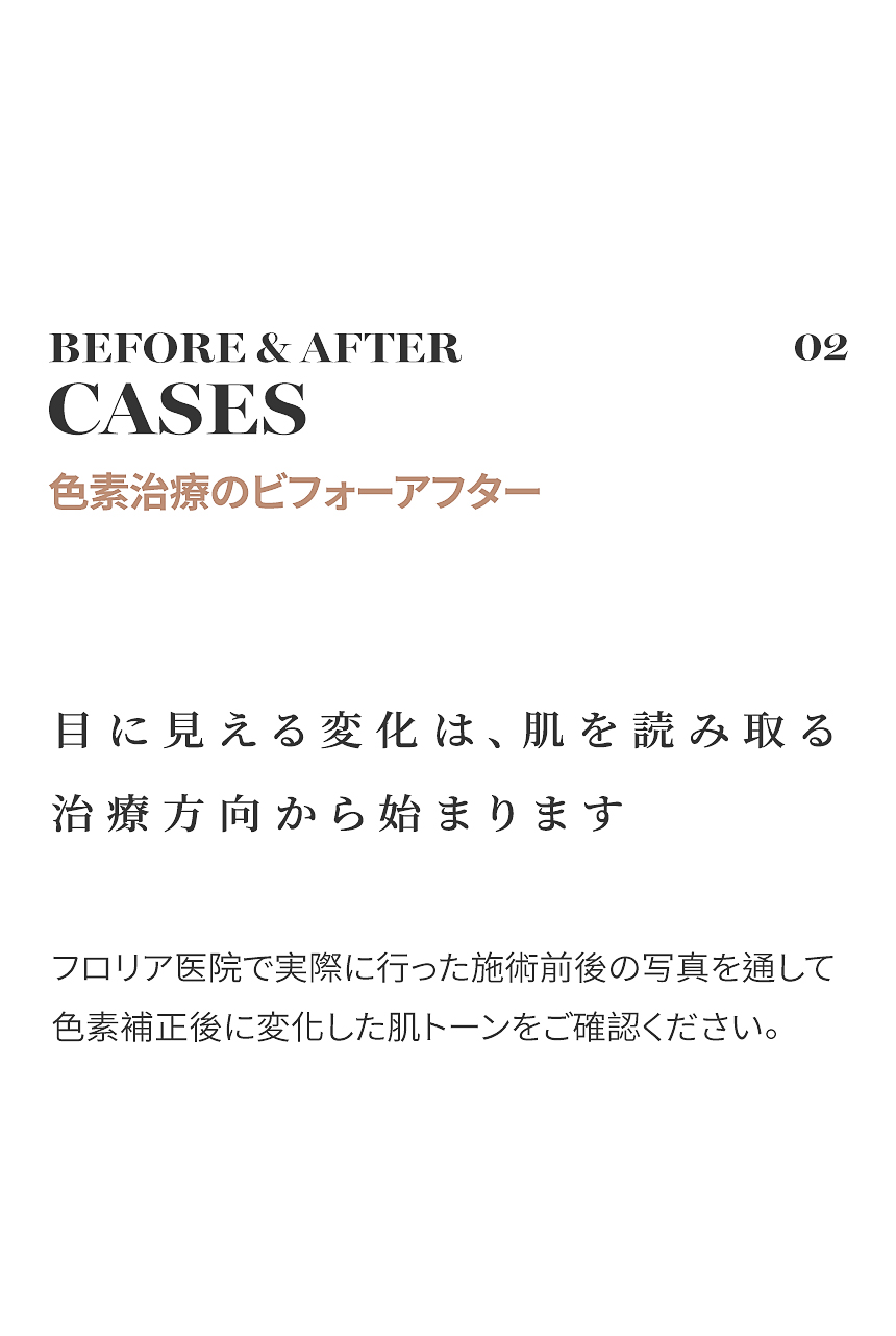肝斑・シミ・色素タイプ別ガイド