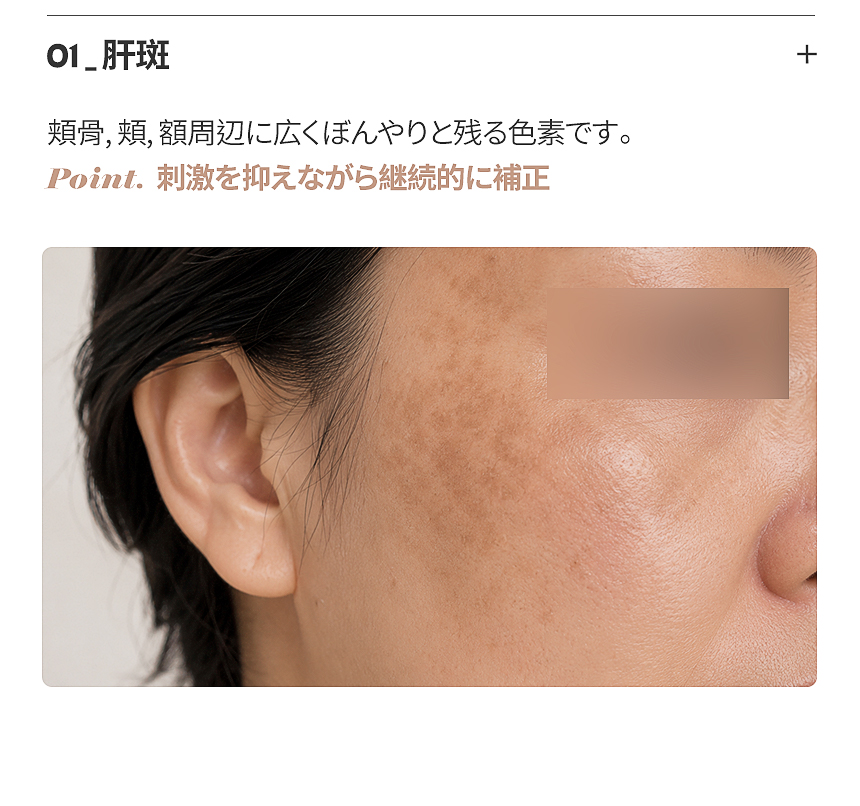 太田母斑の深い色の層に合わせた治療