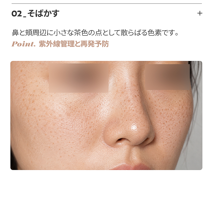 カフェオレ斑のオーダーメイド色素治療