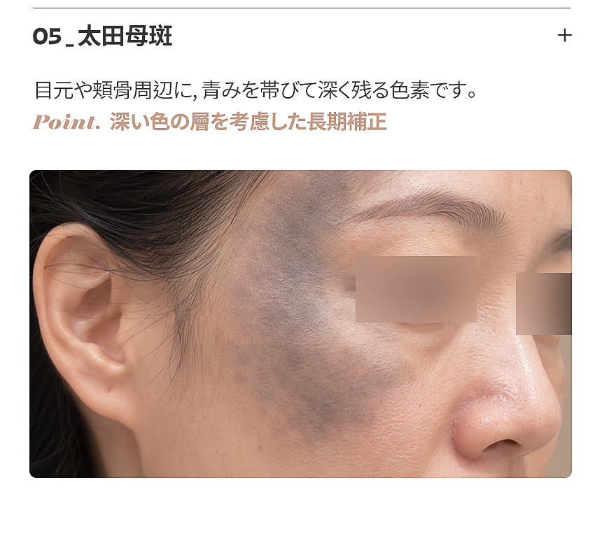 表皮層のシミ・色素分析