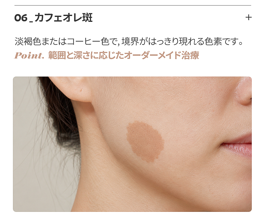 真皮層の深い色素分析