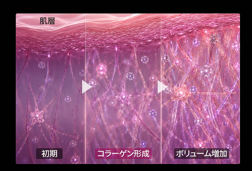 スカルプトラ コラーゲン生成 ハリ改善