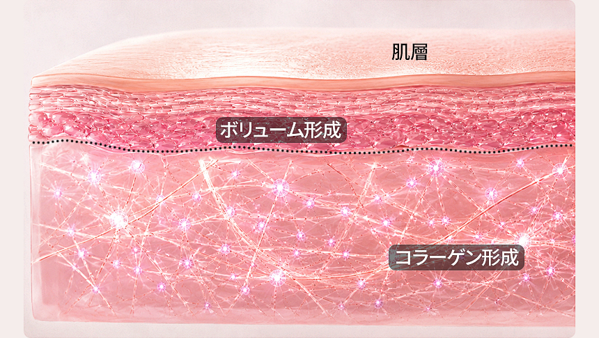 スカルプトラ こめかみ 目の下 頬 ほうれい線 施術部位