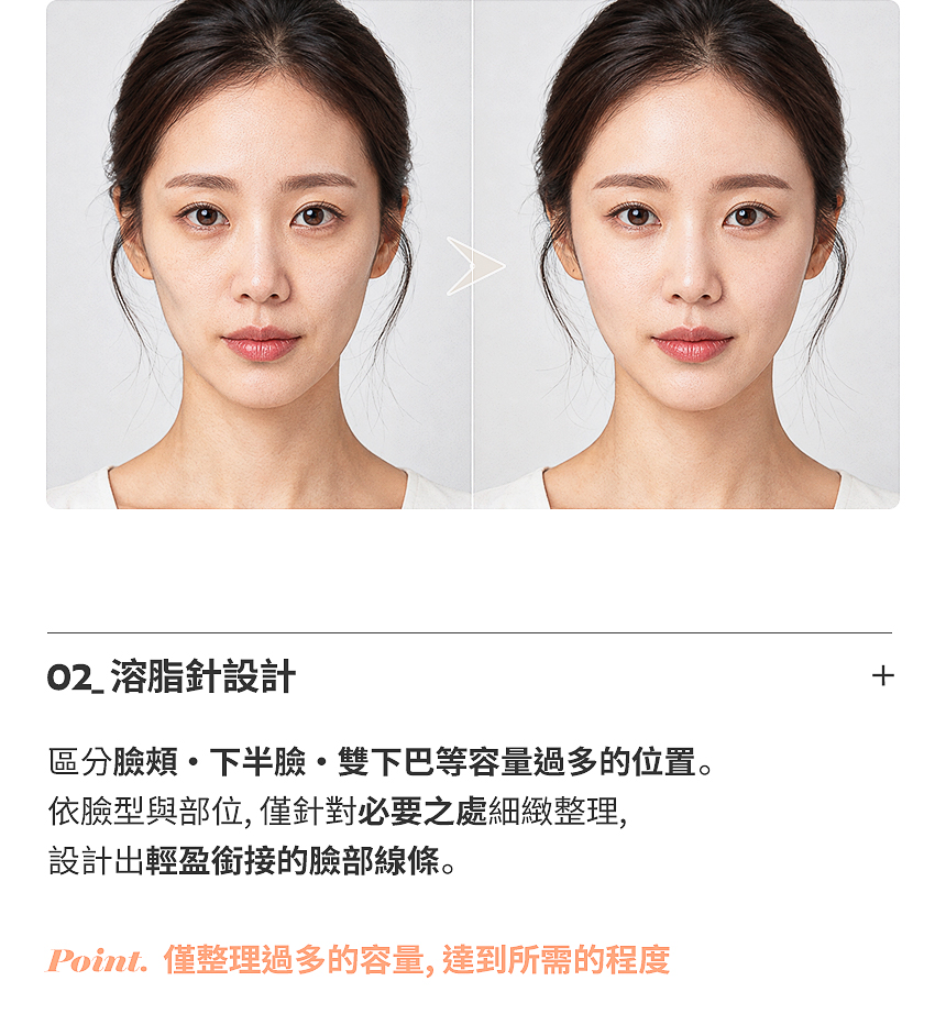 自然銜接凹陷部位的填充劑設計
