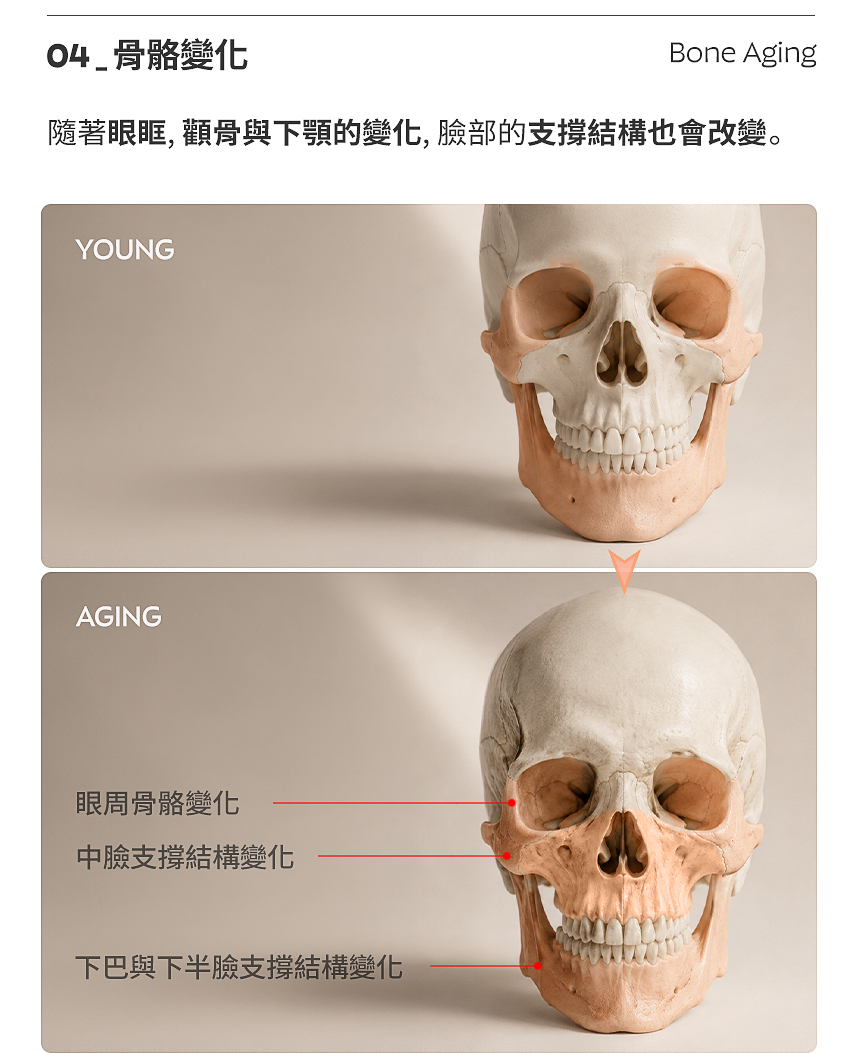 下垂 + 彈性複合設計