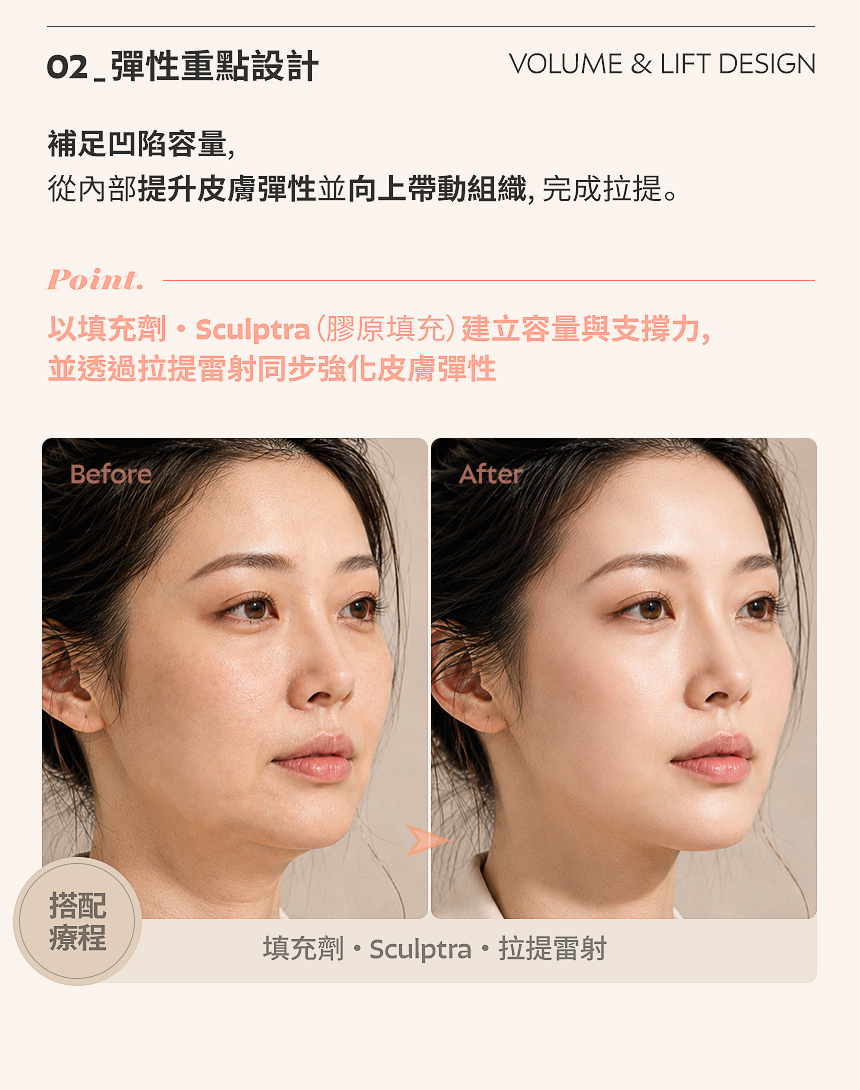 整理堆積並下垂的脂肪，同時保留必要的容量，在不增加重量性下垂的情況下重新建立輪廓線。