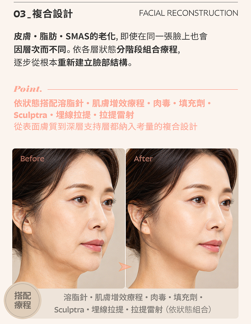 02_ 彈性重點設計