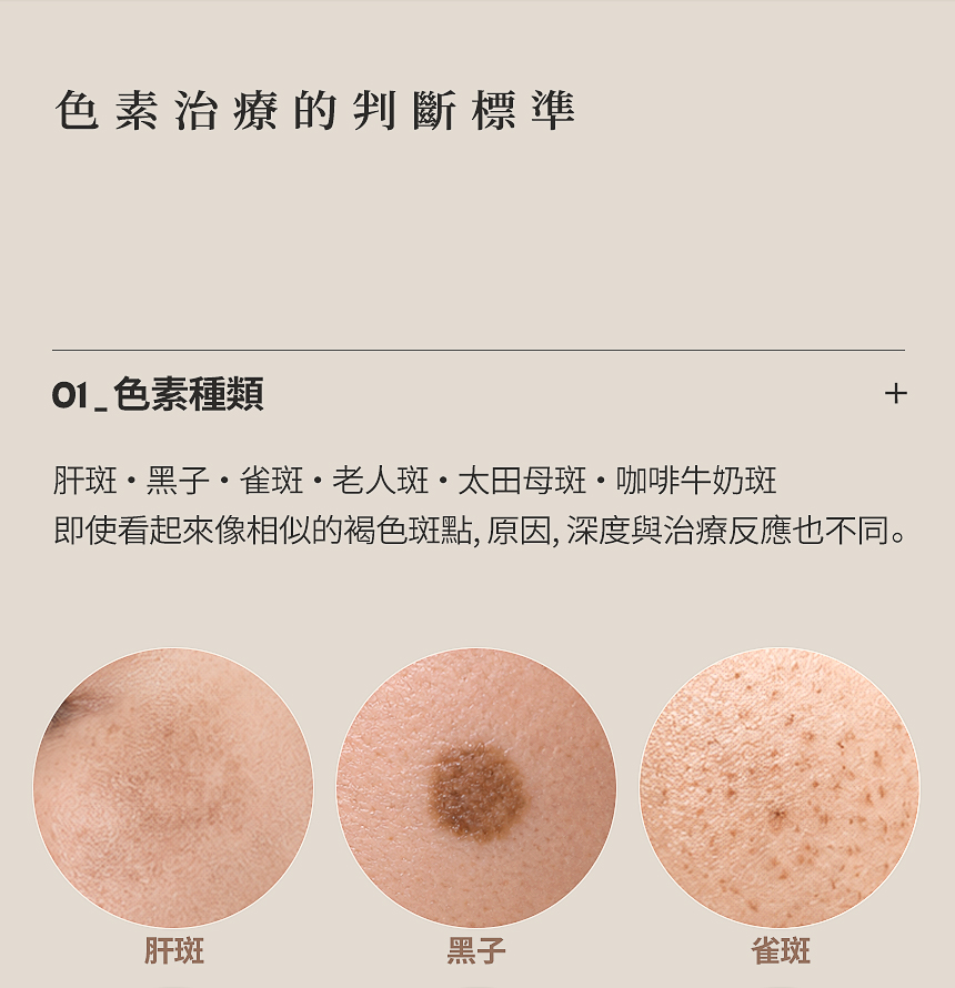 表皮性黑子·雀斑治療